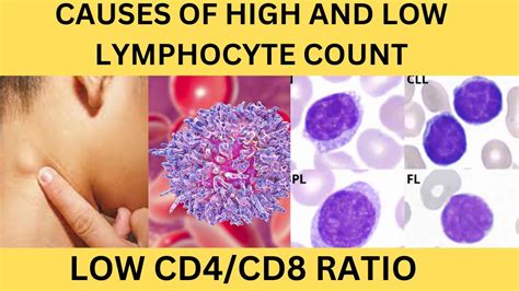 high cd19 count|cause of high cd4 count.